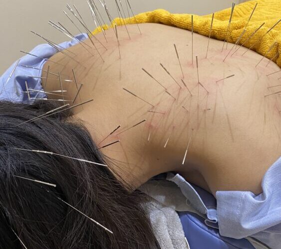 首や肩、顎周辺の緊張なども確認しながら施術を行います。